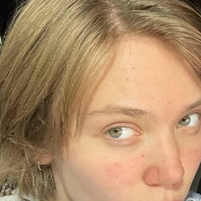 Archelia Tochechka